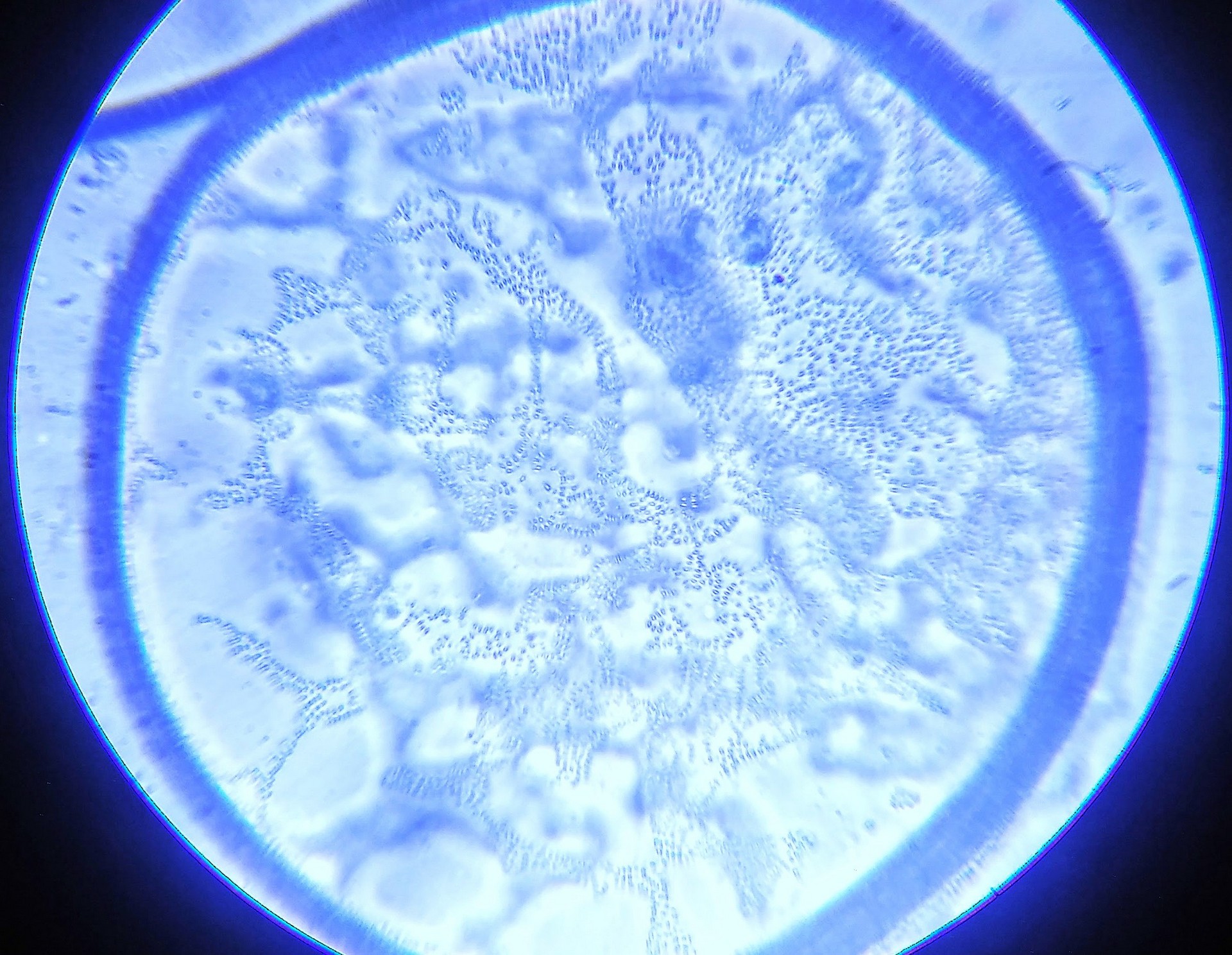 Marine microbe culture
